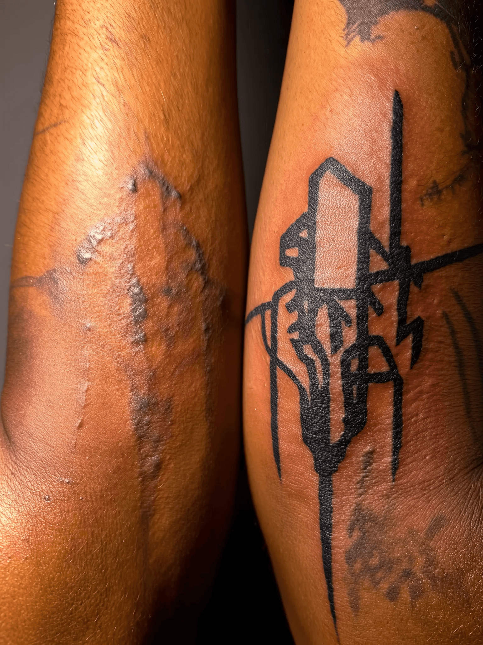 Before and after coverup